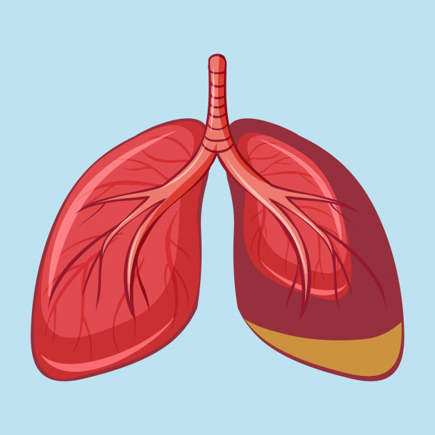 Mês da Hipertensão Pulmonar: doença desconhecida pela maioria da população brasileira